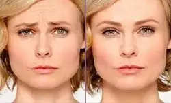 کلینیک زیبایی دکتر مسعود زاهدی