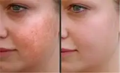 کلینیک زیبایی دکتر مسعود زاهدی