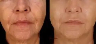 کلینیک زیبایی دکتر مسعود زاهدی