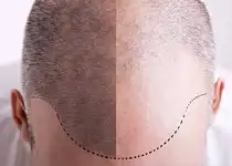 کلینیک زیبایی دکتر مسعود زاهدی