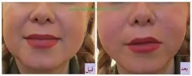 کلینیک زیبایی دکتر مسعود زاهدی