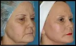 کلینیک زیبایی دکتر مسعود زاهدی