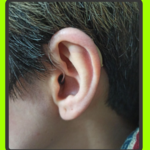 شنوایی سنجی و سمعک اکسیر