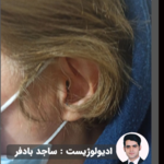 شنوایی سنجی و سمعک اکسیر