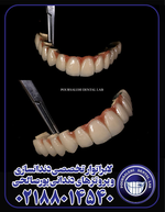 لابراتوار تخصصی دندانسازی و پروتزهای دندانی پورصالحی