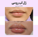 کلینیک زیبایی دکتر زهرا آزادی 