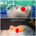 متخصص گوش و حلق بینی دکتر محمد گنجعلی 
