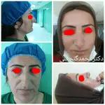 متخصص گوش و حلق بینی دکتر محمد گنجعلی 