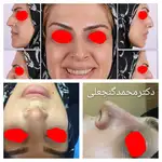 متخصص گوش و حلق بینی دکتر محمد گنجعلی 