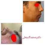 متخصص گوش و حلق بینی دکتر محمد گنجعلی 