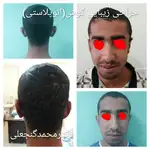 متخصص گوش و حلق بینی دکتر محمد گنجعلی 