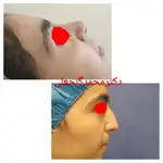 متخصص گوش و حلق بینی دکتر محمد گنجعلی 