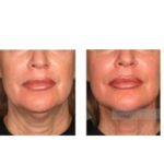 طب سوزنی دکتر واثق