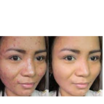 طب سوزنی دکتر واثق