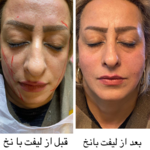 کلینیک زیبایی نامیرا