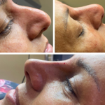 کلینیک زیبایی نامیرا