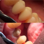 دندانپزشکی دکتر مهسا تاجداری