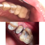دندانپزشکی دکتر مهسا تاجداری