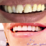 دندانپزشکی دکتر مهسا تاجداری