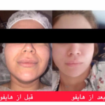 کلینیک پوست و مو زیبایی یاس