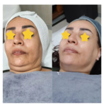 مرکز پوست و فیشیال سُهی