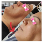 مرکز پوست و فیشیال سُهی