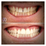 دندانپزشکی دکتر روزبه روزبیانی