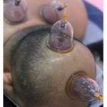 طب سوزنی و طب سنتی  دکتر طبسی 