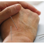 طب سوزنی و طب سنتی  دکتر طبسی 