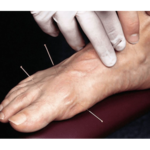 طب سوزنی و طب سنتی  دکتر طبسی 