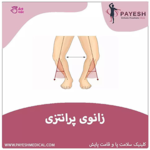 کلینیک ارتوپدی فنی پایش (مرکز تخصصی اسکن و سلامت پا)