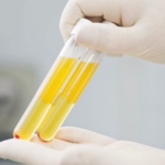 درمان زخم آبادیس