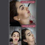 کلینیک لیزر و زیبایی نفیسه پناه