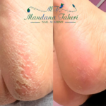 بهترین مرکز کاشت ناخن ماندانا طاهری