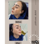 کلینیک زیبایی علی عبدی