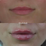 کلینیک زیبایی علی عبدی