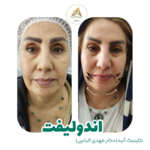 کلینیک پوست و زیبایی آنید   