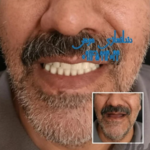 دندانسازی مومن