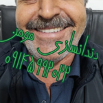 دندانسازی مومن