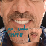 دندانسازی مومن