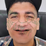 دندانسازی مومن