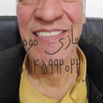 دندانسازی مومن