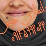دندانسازی مومن