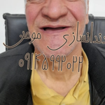 دندانسازی مومن