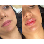 کلینیک پوست مو زیبایی لیزر دکتر اصفهانی