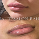 مرکز زیبایی و سولاریوم رها بیوتی