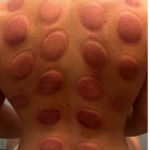 مرکز ماساژ سلیمانی