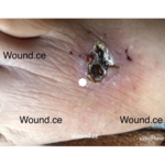 مرکز درمانی زخم و ازون تراپی نیاوران