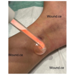 مرکز درمانی زخم و ازون تراپی نیاوران