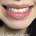 مرکز دندانپزشکی زیبایی و مدرن دکتر سحر گشا